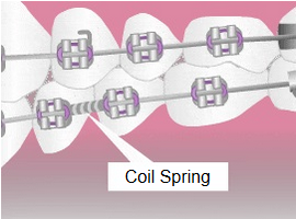 Coil Spring